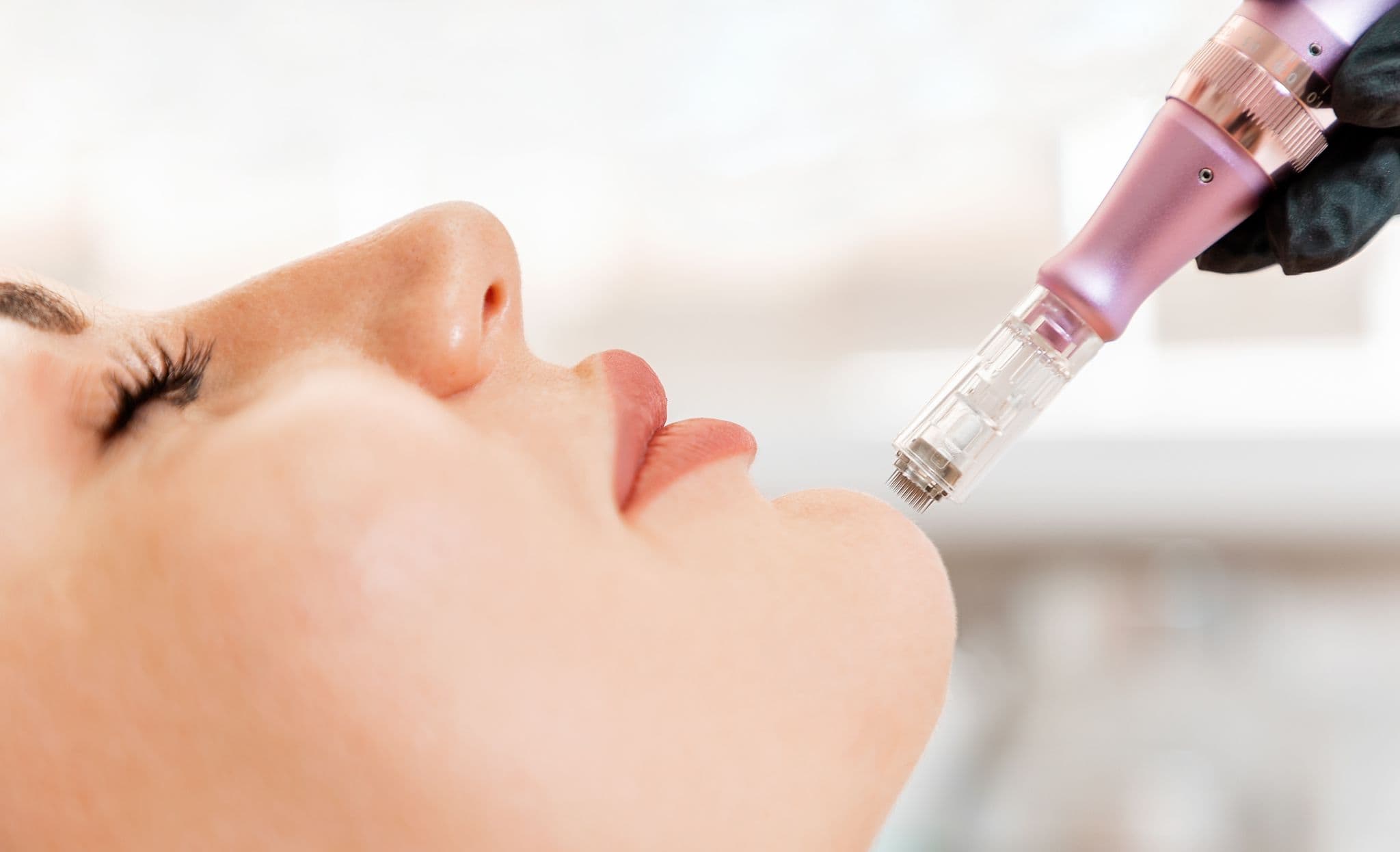 Microneedling Ludwigsburg: Gesichtsbehandlung bei DAISY JUNE in Freiberg am Neckar